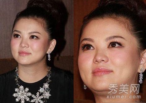 盤點(diǎn)產(chǎn)后發(fā)福女星王艷雙下巴明顯