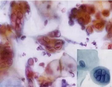 ϴӣךWM(jn)ھϴO(sh)ꑌҼ